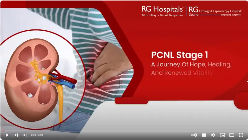 RG Stone Urology & Laparoscopy Hospital