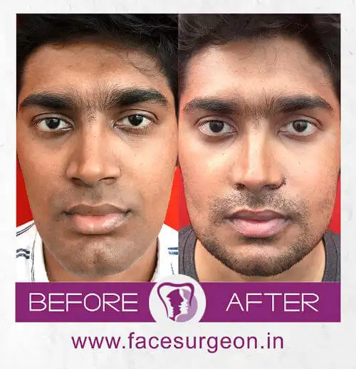 Richardsons Dental & Craniofacial Hospital