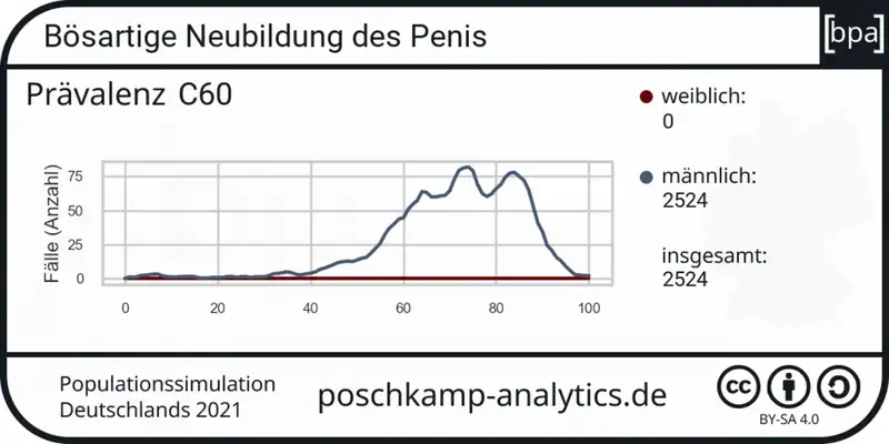 Augenklinik Universitätsallee Bremen